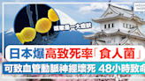 遊日注意｜日本爆高致死率「食人菌」，可致血管動脈神經壞死48小時致命！咳嗽是一大症狀