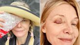 Michelle Pfeiffer Shows Off Black Eye After Pickleball Mishap