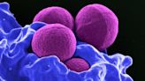 US study finds shifting resistance patterns in Staph aureus