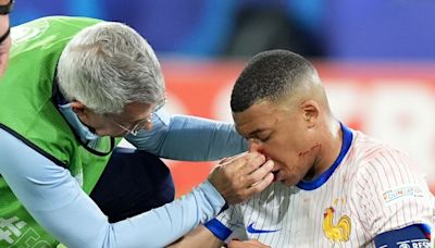 Mbappé no evitará el quirófano por su fractura de nariz: tendrá que elegir si operarse ahora o tras la Eurocopa