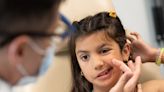 An 11-year-old born with facial paralysis became the first child to receive a complex surgery that will give her a symmetric smile