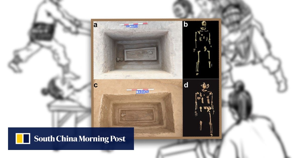 Ancient China skeletons shed light on widespread practice of penal amputation