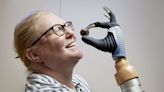 Woman Becomes First Person to Be Fitted for Bionic Hand That Integrates Nervous and Skeletal Systems