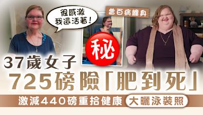 成功瘦身｜37歲女子725磅險「肥到死」 激減440磅重拾健康大曬泳裝照