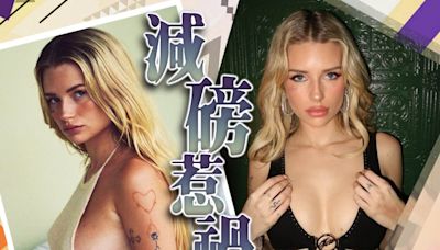 超模姬摩絲妹妹Lottie Moss自爆因以糖尿病藥減肥要緊急送院