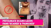Priyanka Chopra's 'Bruised' BTS Video Leaves Fans 'Panicked': 'When You Do Action Movies, It’s Really Glamorous' | Etimes...