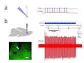 Optogenetics