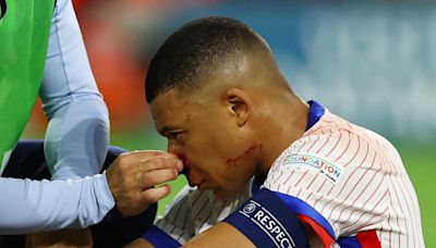 Euro-2024 : Kylian Mbappé pas (encore) forfait contre les Pays-Bas