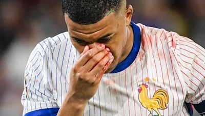 Mbappé se fractura la nariz, regresa a la concentración y jugará con máscara