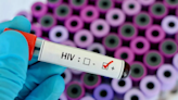 Tripura Government issues clarification on HIV Outbreak - ET HealthWorld