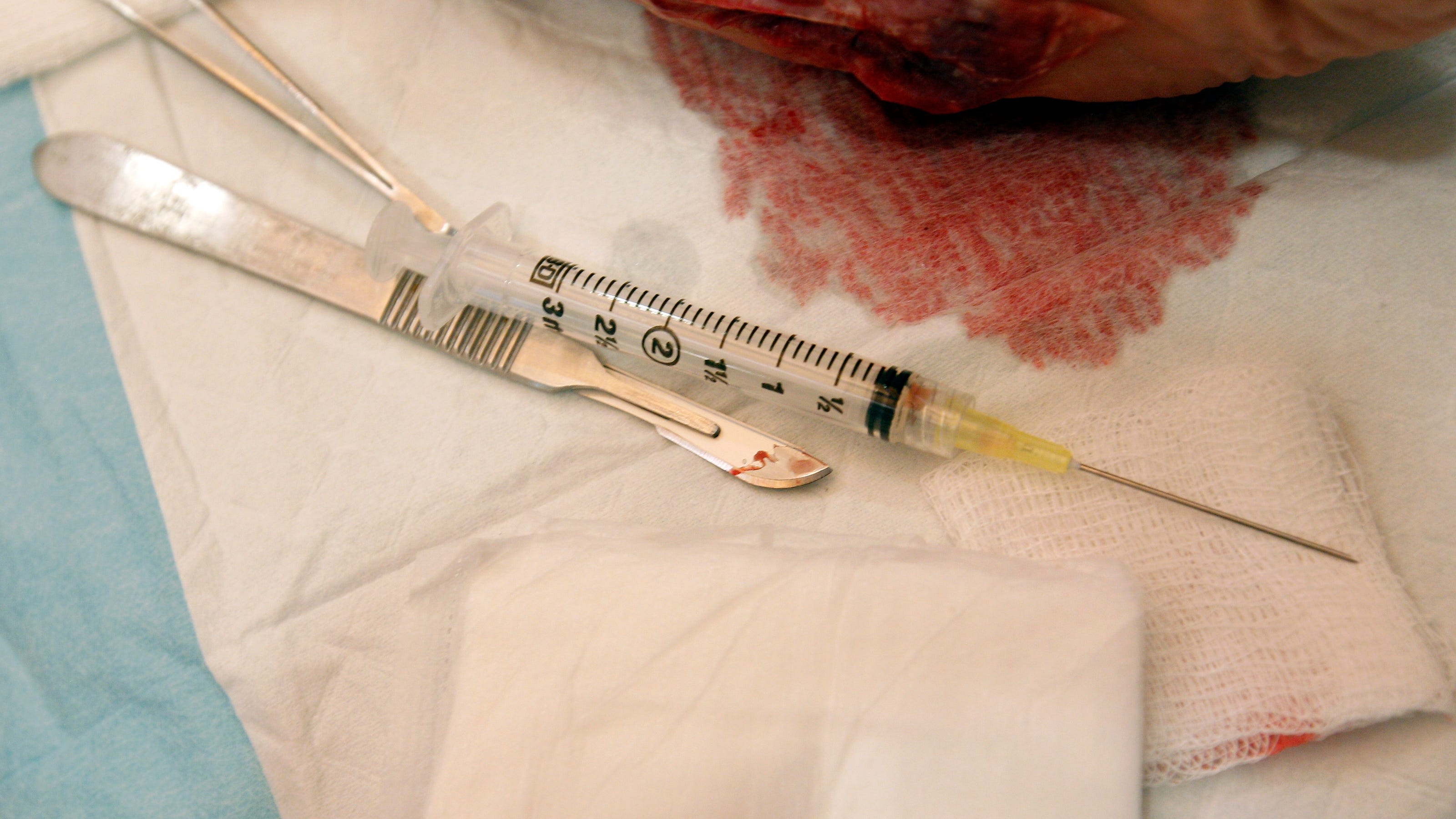 Stem cell injections in Mexico can be hazardous. Report identifies US victims.