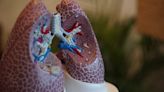 Mini Lung Models Reveal New Ways in Which COVID-19 Infection Spreads