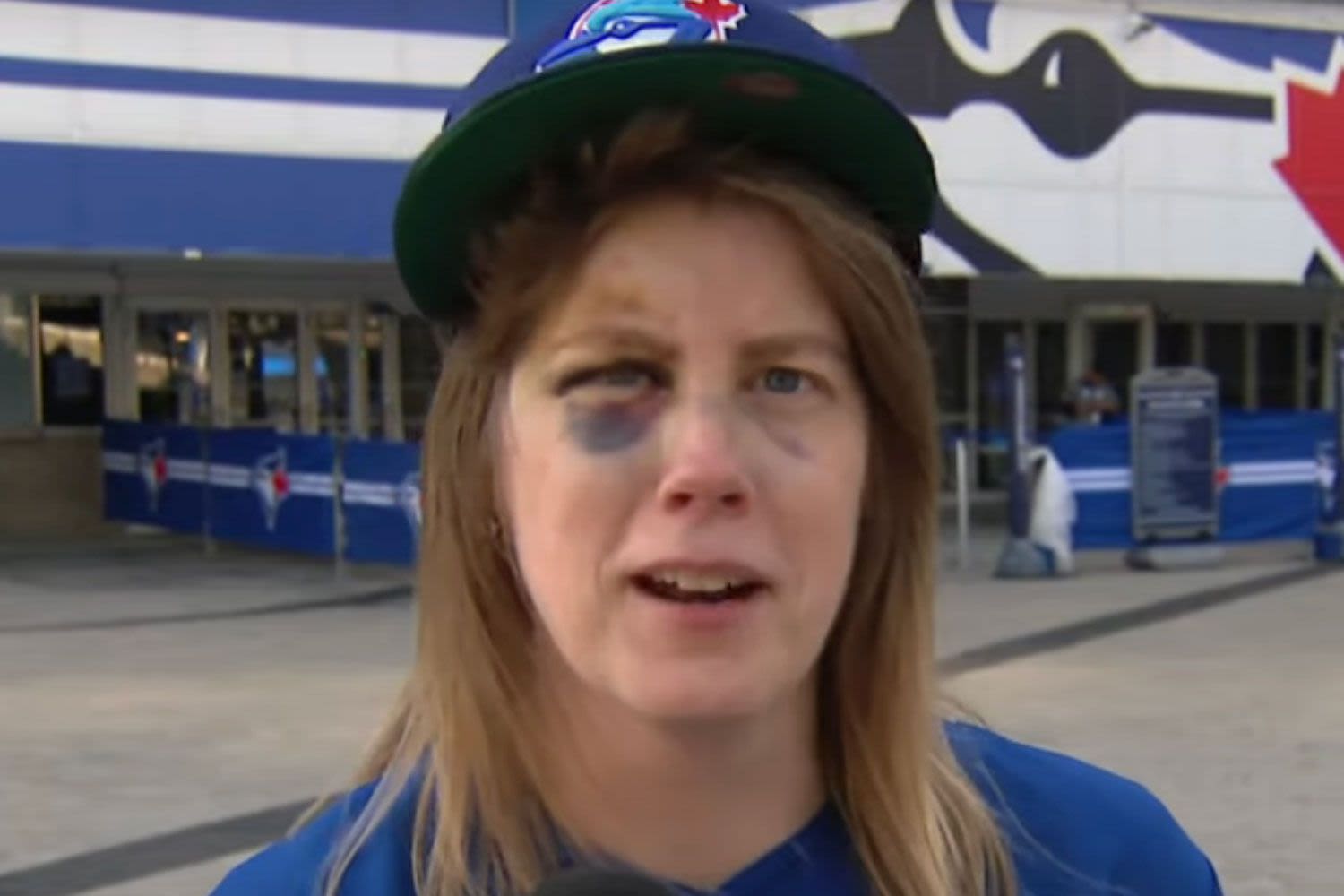 Toronto Blue Jays Fan Hit by 110 MPH Foul Ball Gets Own Trading Card: 'I Got My Face Mashed In'