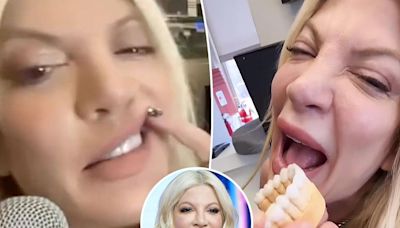 Tori Spelling has ‘never been happier’ since getting veneers to replace her ‘disgusting’ teeth: ‘I smile now’