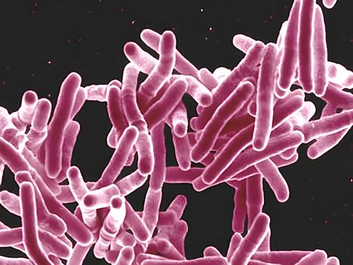 What to know about TB after outbreak in Long Beach sickens 14