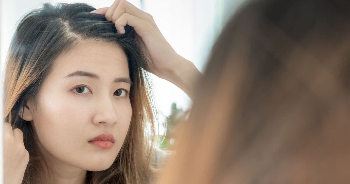 Bridgerton star shares 47p beauty tip that transformed her thinning hair