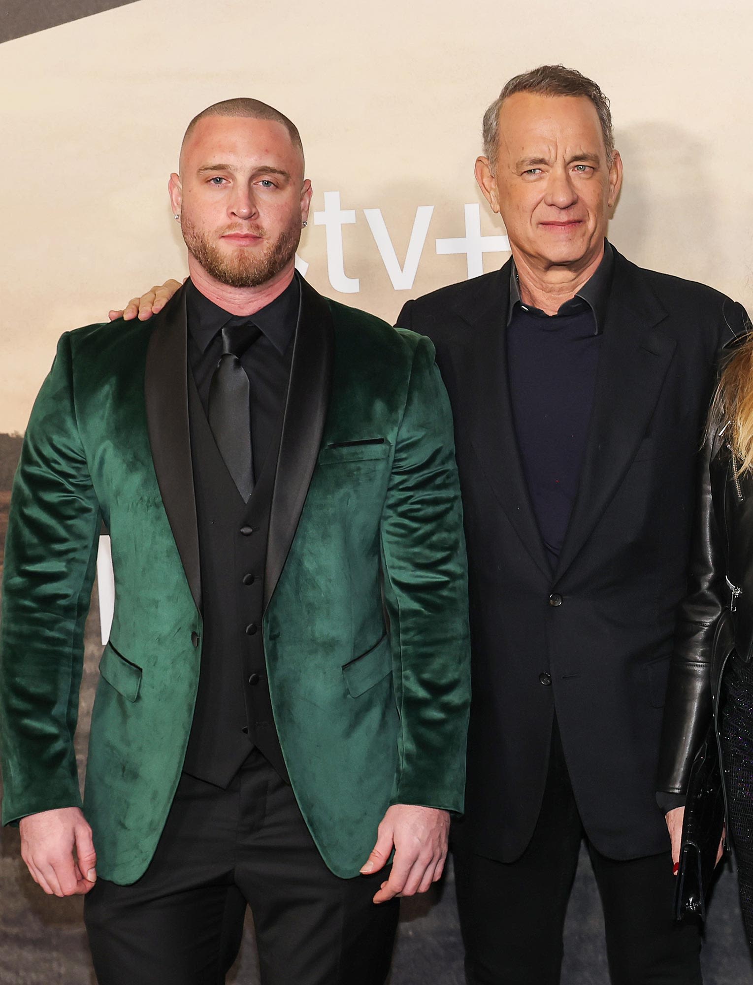 Tom Hanks’ Son Chet Hanks Has ‘No Shame’ After Getting His Forehead ‘Blasted With Botox’