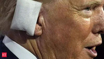 What is the ear reconstruction surgery that Donald Trump may have to undergo?