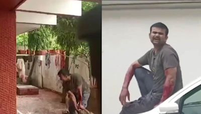 'Help Me': Delivery Man Attacked By 'Pet' Pitbull in Chhattisgarh's Raipur, Chilling Video Goes Viral - News18
