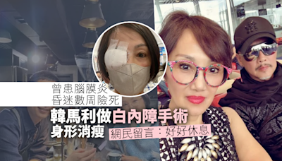 曾患腦膜炎險死！韓馬利做白內障手術 身形消瘦