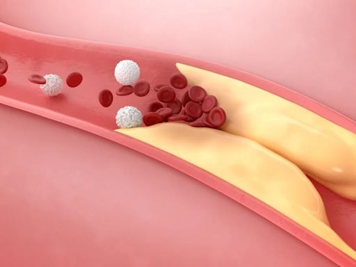 ¿Colesterol alto? Éstas frutas cuidan de tu corazón y arterias