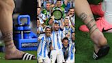 Images of Lionel Messi's ‘destroyed’ ankle go viral after freak Copa America final injury