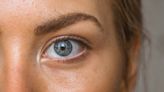 Qual a cor de olhos mais comum? E a mais rara?