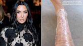 Kim Kardashian Shares How She Gets a 'Little Bit of Relief' from 'Painful' Psoriasis Flare-Up