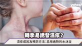 轉季易誘發濕疹？中醫講解濕疹成因及預防方法：戒口及忌用過熱的水沐浴