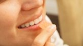 Los 3 peores alimentos para tus dientes y 3 formas de prevenir el daño - La Tercera