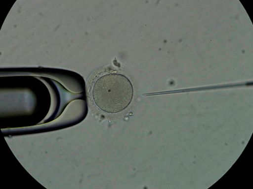 Científicos nipones logran generar precursores de espermatozoides y óvulos con células iPS