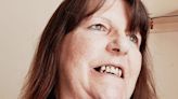 NHS crisis laid bare as Tobye pulls out tooth with pliers