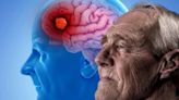 Estudio: los dos síntomas frecuentes que anticipan el Alzheimer