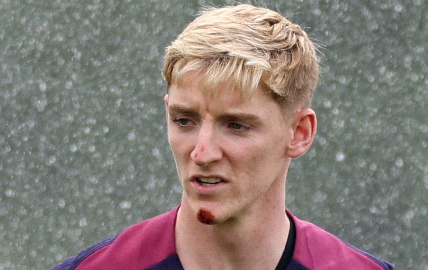 Anthony Gordon grazes face after falling off bike with England