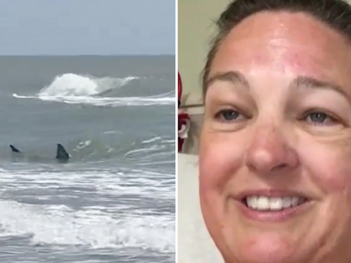 Texas South Padre Island shark attack survivor says her leg is ‘pretty much gone’