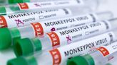 Russia registers first case of monkeypox