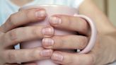 What Causes White Spots on Nails and How to Treat Them