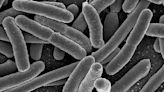 Researchers identify new antibiotic-resistant strain of E. coli in China