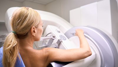 What to Know About Breast Cancer Screening Guidelines