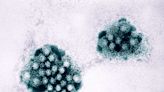 What to know about the symptoms and treatment of norovirus as it spreads across the US