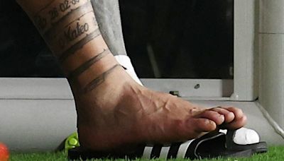 El tobillo de Lionel Messi en la final de la Copa América: qué es un esguince y cuánto tarda en recuperarse