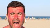 This ‘common’ mistake with sunscreen gets people burned, DC-area dermatologist says - WTOP News