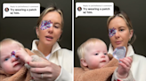 Mom documents attempts to get baby to wear eyepatch, goes as you'd expect