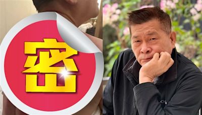 澎恰恰赴陸拍戲還債！背部「滿滿血痕照」嚇壞網 嘆：還好撐住了