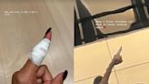 Zendaya gets stitches after injuring finger in cooking accident: ‘This is why I don’t cook’