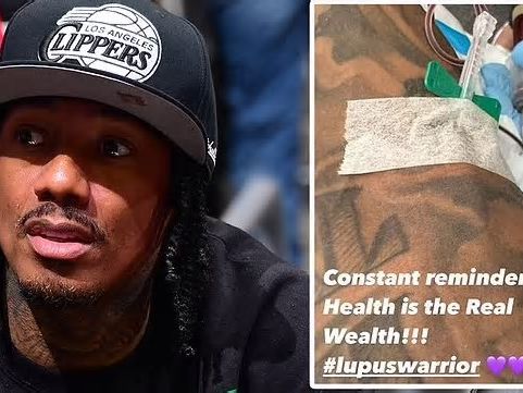 Nick Cannon says he’s a ‘lupus warrior’ as he undergoes blood treatment