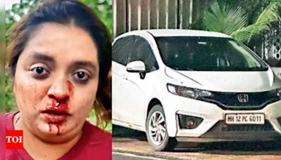 Pune car driver punches hotel exec in the face for 'drive better' remark | Pune News - Times of India
