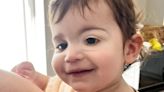 Tot whose bloodshot eye turned out to be cancer gets 'amazing' prosthetic eye