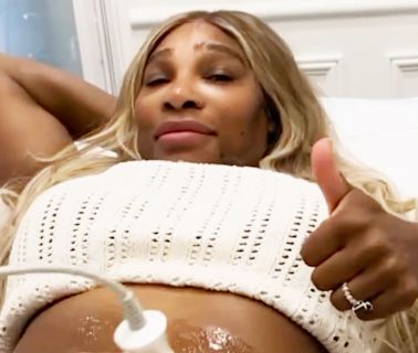 Serena Williams Reveals Tummy-Tightening Procedure but Says 'I Will Always Love My Birthing Scars'