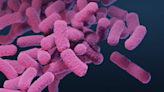 What parents need to know about shigella — an antibiotic-resistant bacteria affecting children under 5